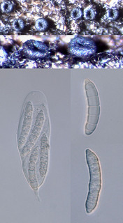 Thaxteriella pezizula