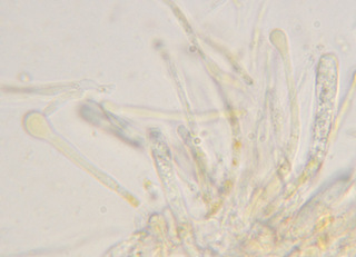 Orbilia xanthostigma
