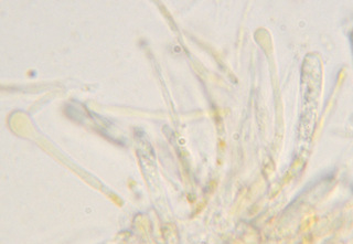 Orbilia xanthostigma