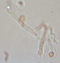 Coniophora olivacea