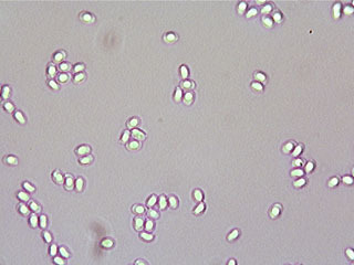 Tricholoma portentosum