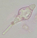 Lophiostoma aquaticum
