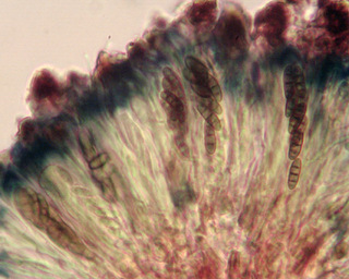Dactylospora parasitica