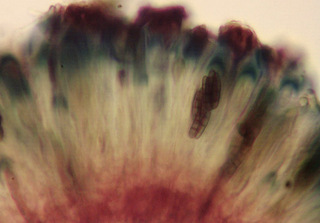 Dactylospora parasitica