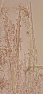 Albotricha acutipila