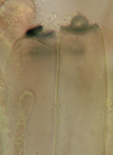 Peziza echinospora