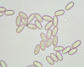 Peziza echinospora
