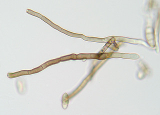 Cladosporium macrocarpum