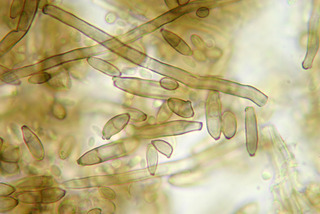 Cladosporium tenuissimum