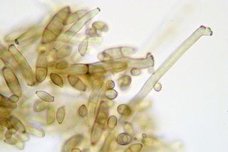 Cladosporium tenuissimum