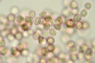 Microbotryum silenes-inflatae