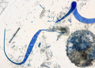 Mycocentrospora acerina