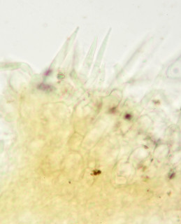 Sphaerosporella brunnea
