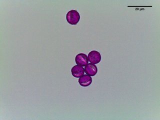 Hypericum densiflorum, pollen