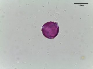 Corylopsis, pollen