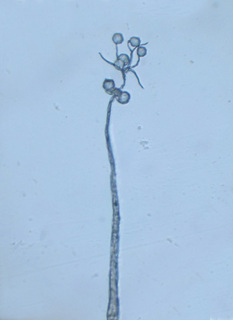 Echinostelium paucifilum