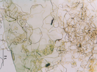 Calomyxa metallica