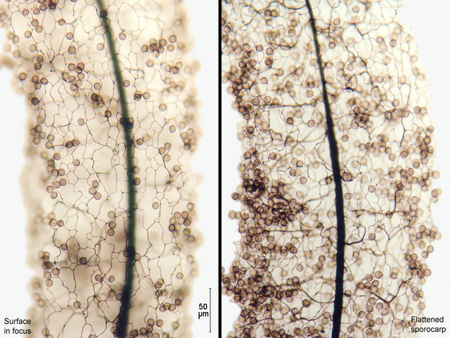 Stemonitis fusca under microscope