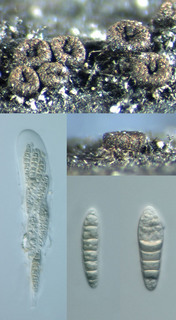Thaxteriella sp near pezizula