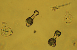 Conidiobolus obscurus, spores