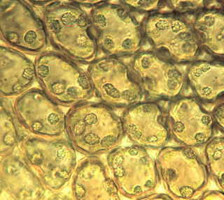 Frullania anomala, leaf lobe median cells, cell walls and oilbodies