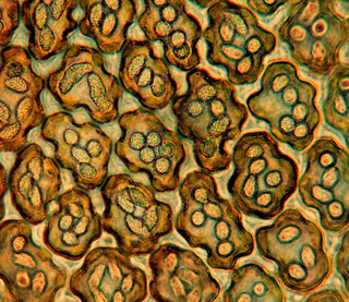 Frullania pycnantha, oil bodies