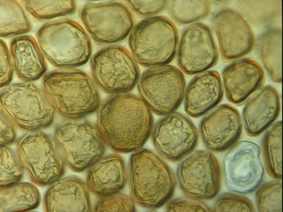 Frullania tamarisci, ocelli in basal lobe cells