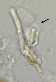 Hyphodontia pallidula