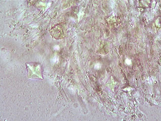 Phlebia livida