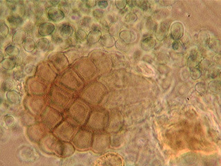 Dictyosporium toruloides