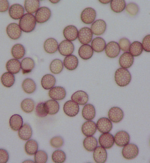 Microbotryum stellariae