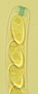 Dumontinia tuberosa