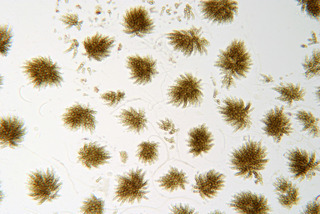 Cheirospora botryospora