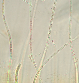 Rivularia haematites