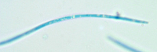 Septoria scabiosicola