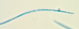 Septoria scabiosicola