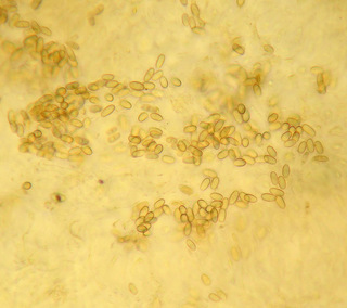 Rhizopogon luteolus