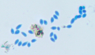 Calcarisporium arbuscula