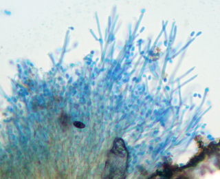Calcarisporium arbuscula