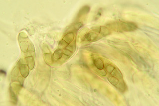 Venturia maculiformis