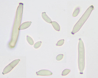 Cladosporium uredinicola