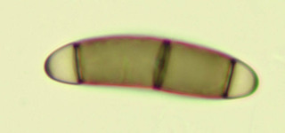 Chaetosphaerella phaeostroma