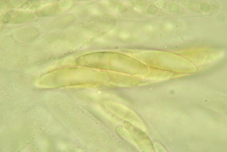 Chaetosphaerella phaeostroma
