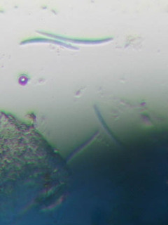 Septoria hydrocotyles