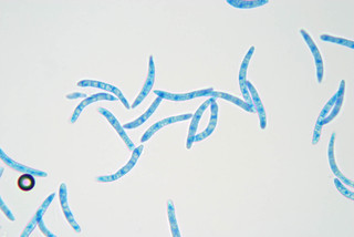 Mycosphaerella ulmi