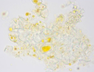 Chrysomyxa pyrolata