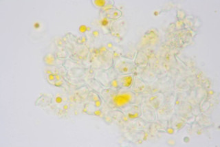 Chrysomyxa pyrolata