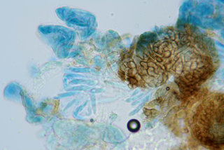 Mycosphaerella hedericola