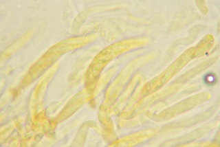 Mycosphaerella hedericola