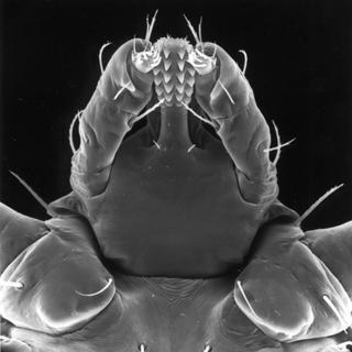 Dermacentor variabilis, female, front head bottom
